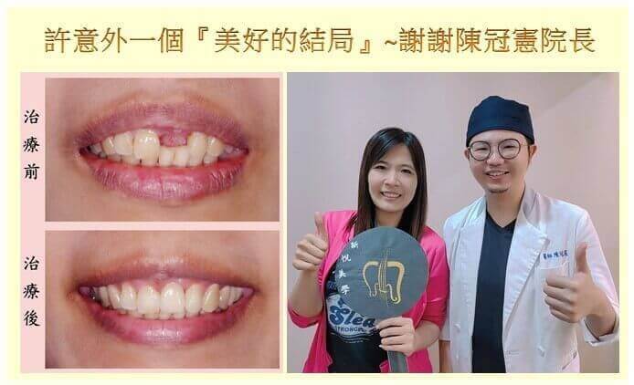 新悅美學牙醫診所的案例分享圖片