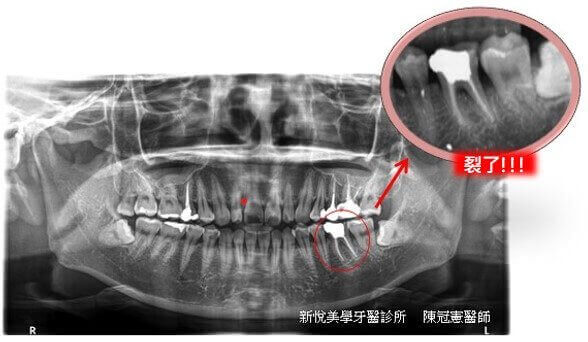 新悅美學牙醫診所的案例分享圖片