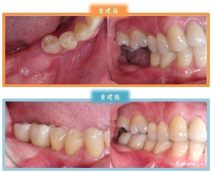 新悅美學牙醫診所的案例分享圖片