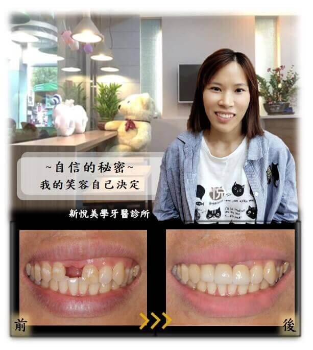 新悅美學牙醫診所的案例分享圖片