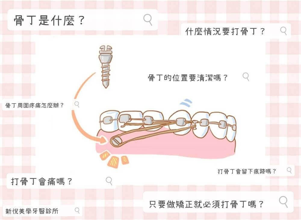 新悅美學牙醫診所的衛教專區圖片