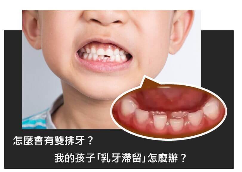 新悅美學牙醫診所的衛教專區圖片