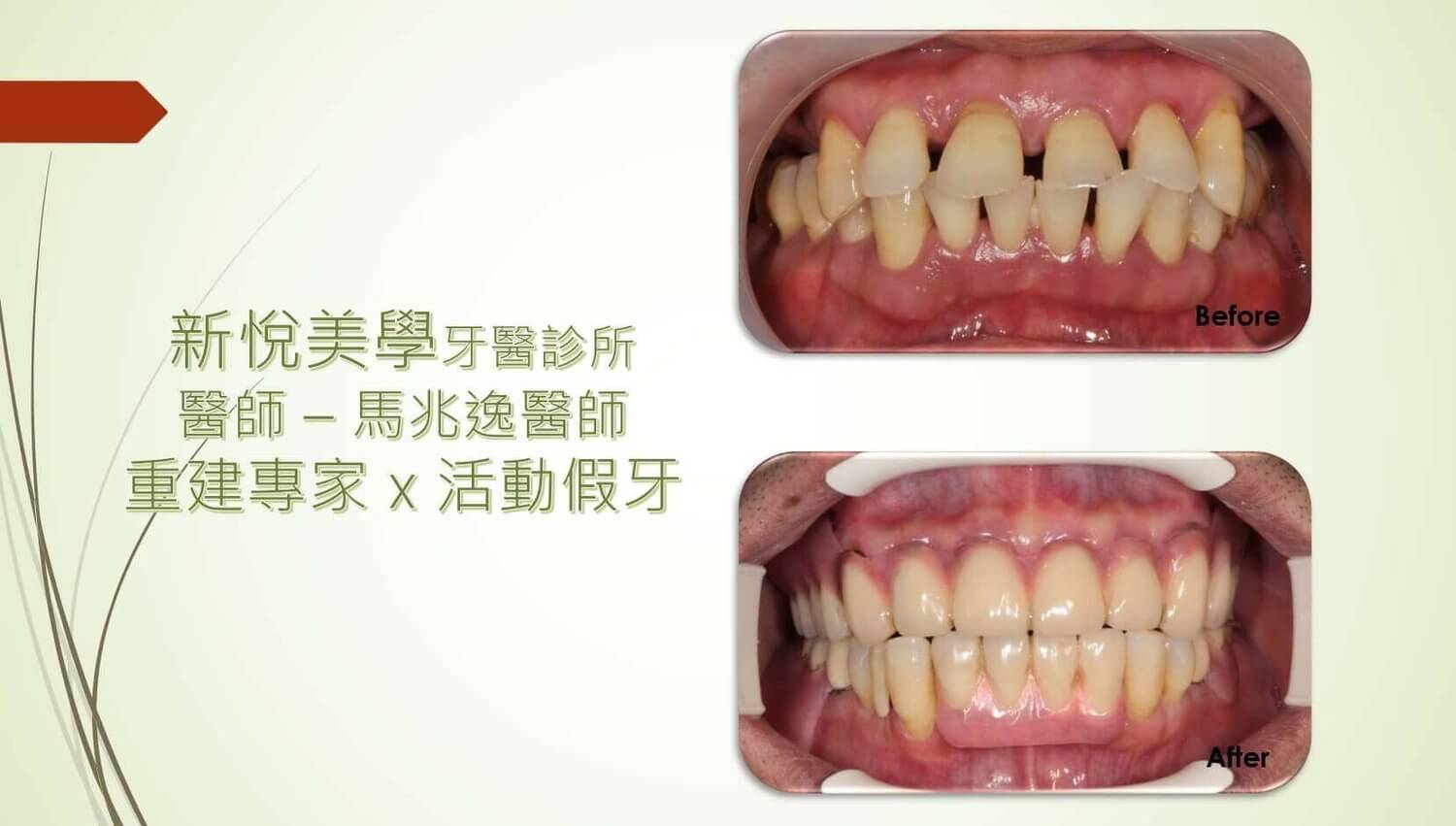 新悅美學牙醫診所的案例分享圖片