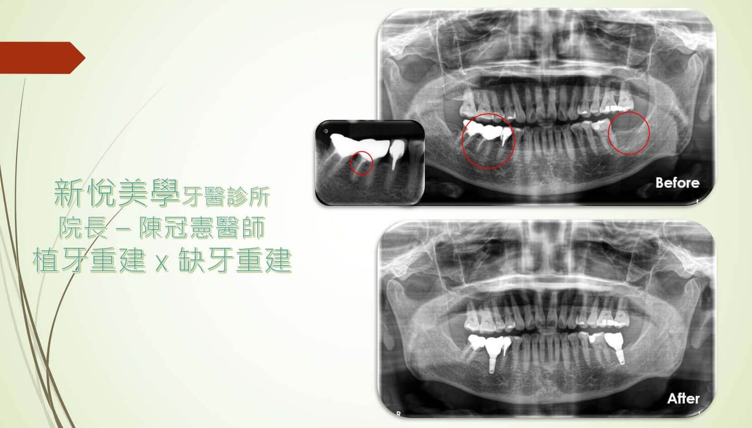 新悅美學牙醫診所的案例分享圖片