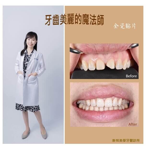 新悅美學牙醫診所的案例分享圖片