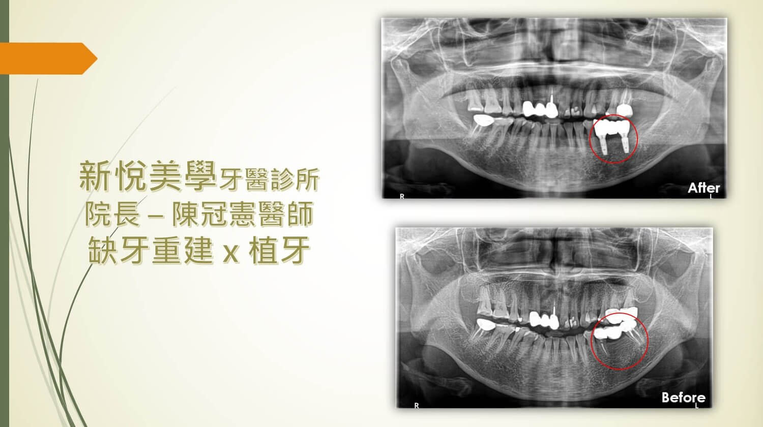 新悅美學牙醫診所的案例分享圖片