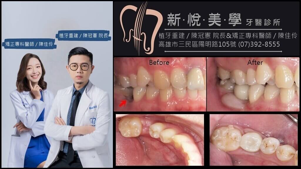 新悅美學牙醫診所的案例分享圖片