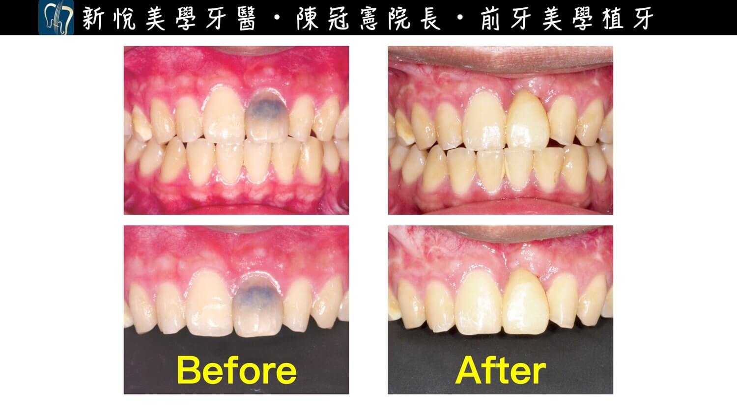新悅美學牙醫診所的案例分享圖片