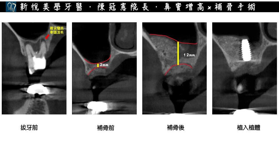 新悅美學牙醫診所的案例分享圖片