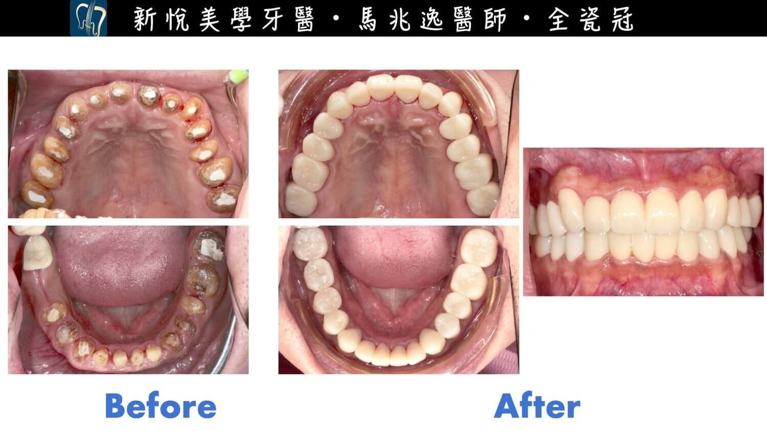 新悅美學牙醫診所的案例分享圖片