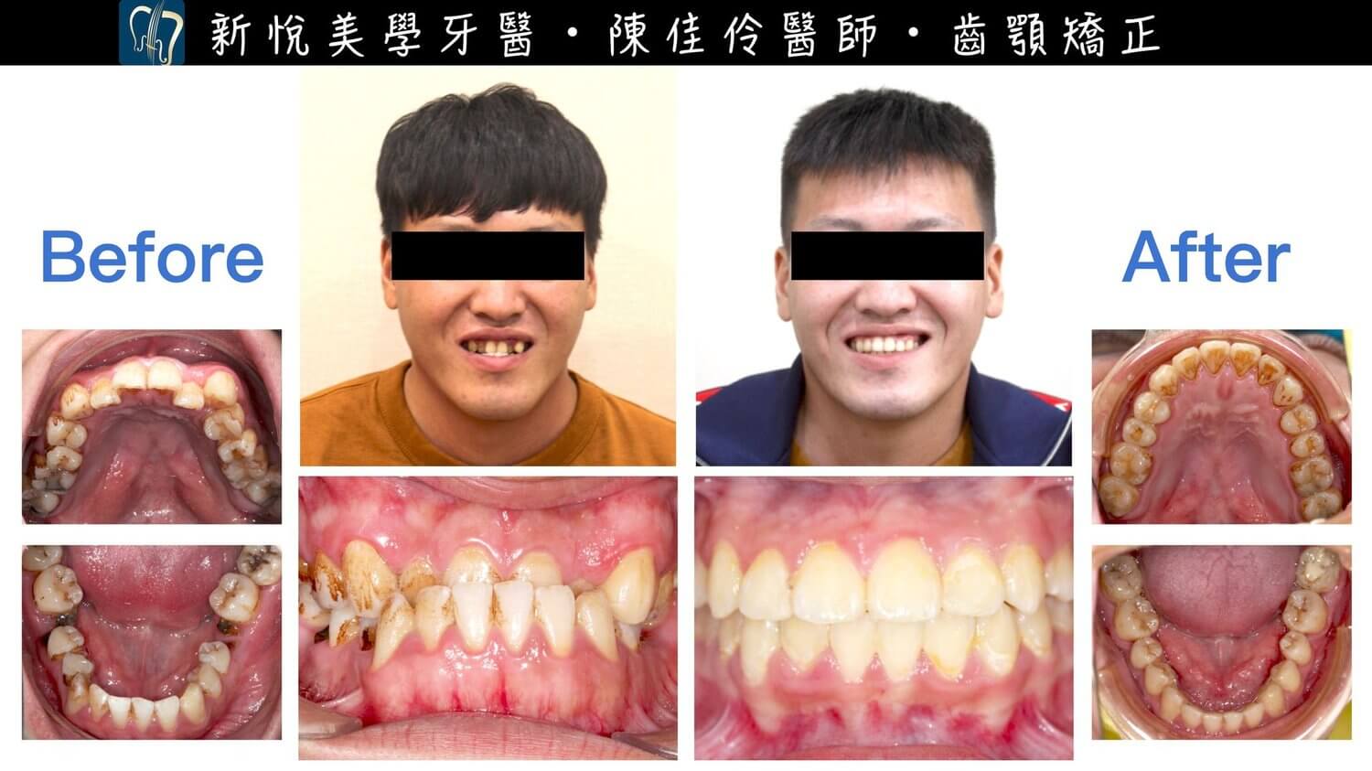 新悅美學牙醫診所的案例分享圖片