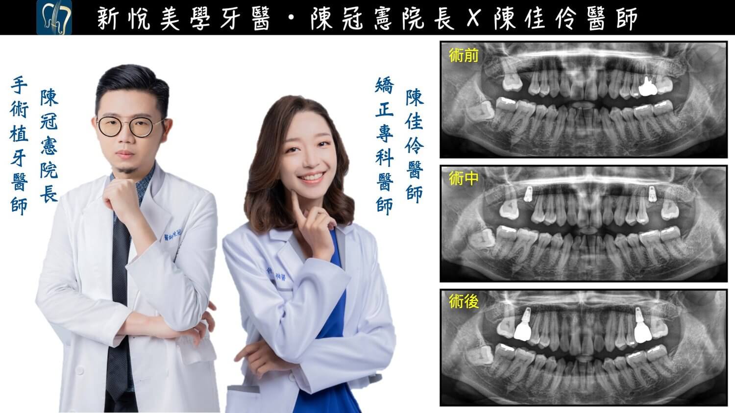 新悅美學牙醫診所的案例分享圖片