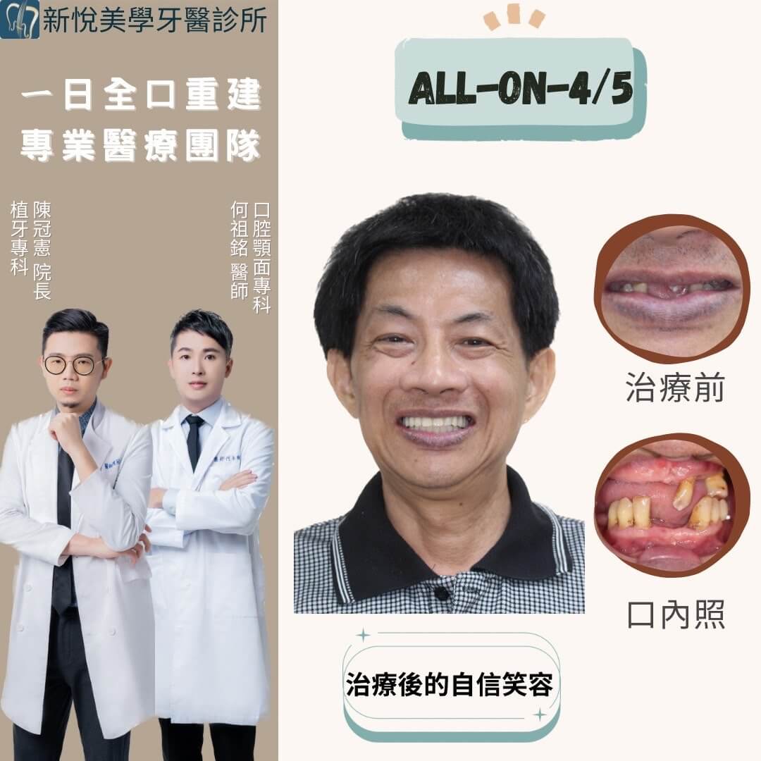 新悅美學牙醫診所的案例分享圖片