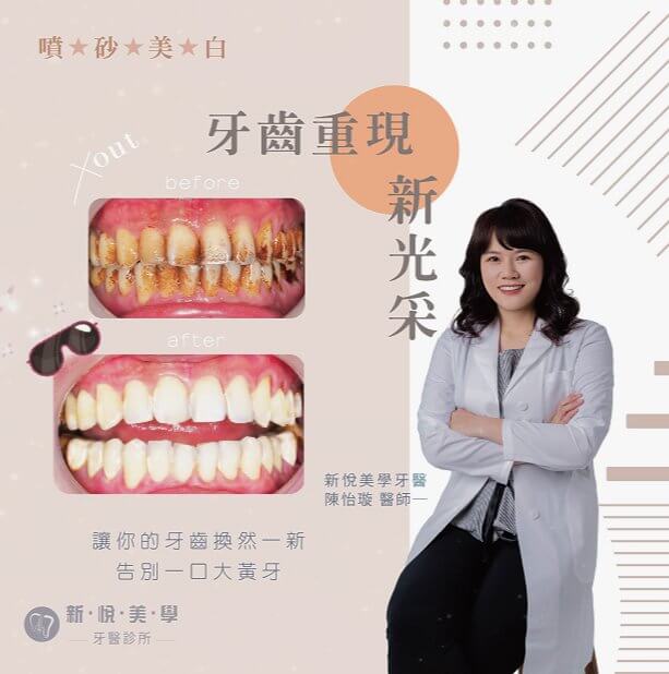 新悅美學牙醫診所的案例分享圖片