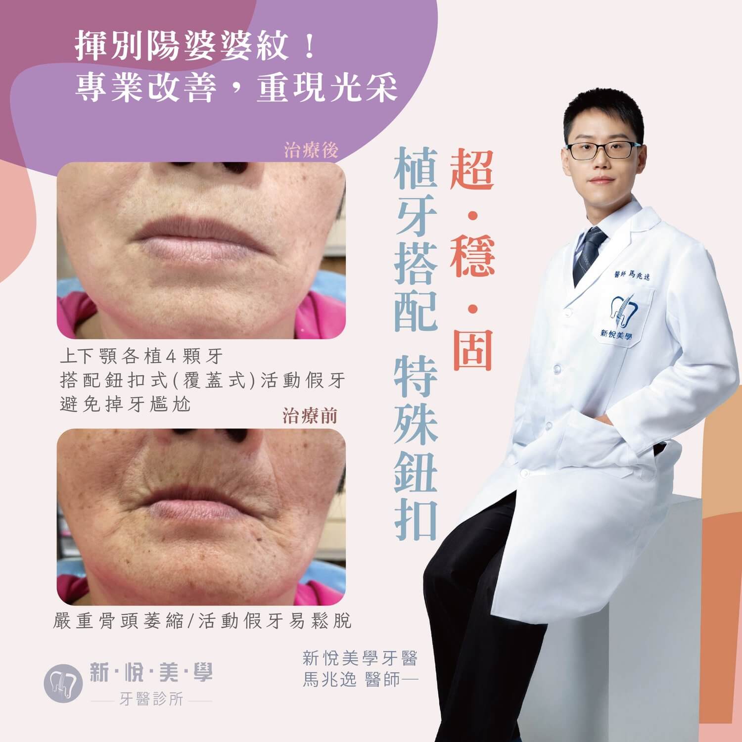 新悅美學牙醫診所的案例分享圖片