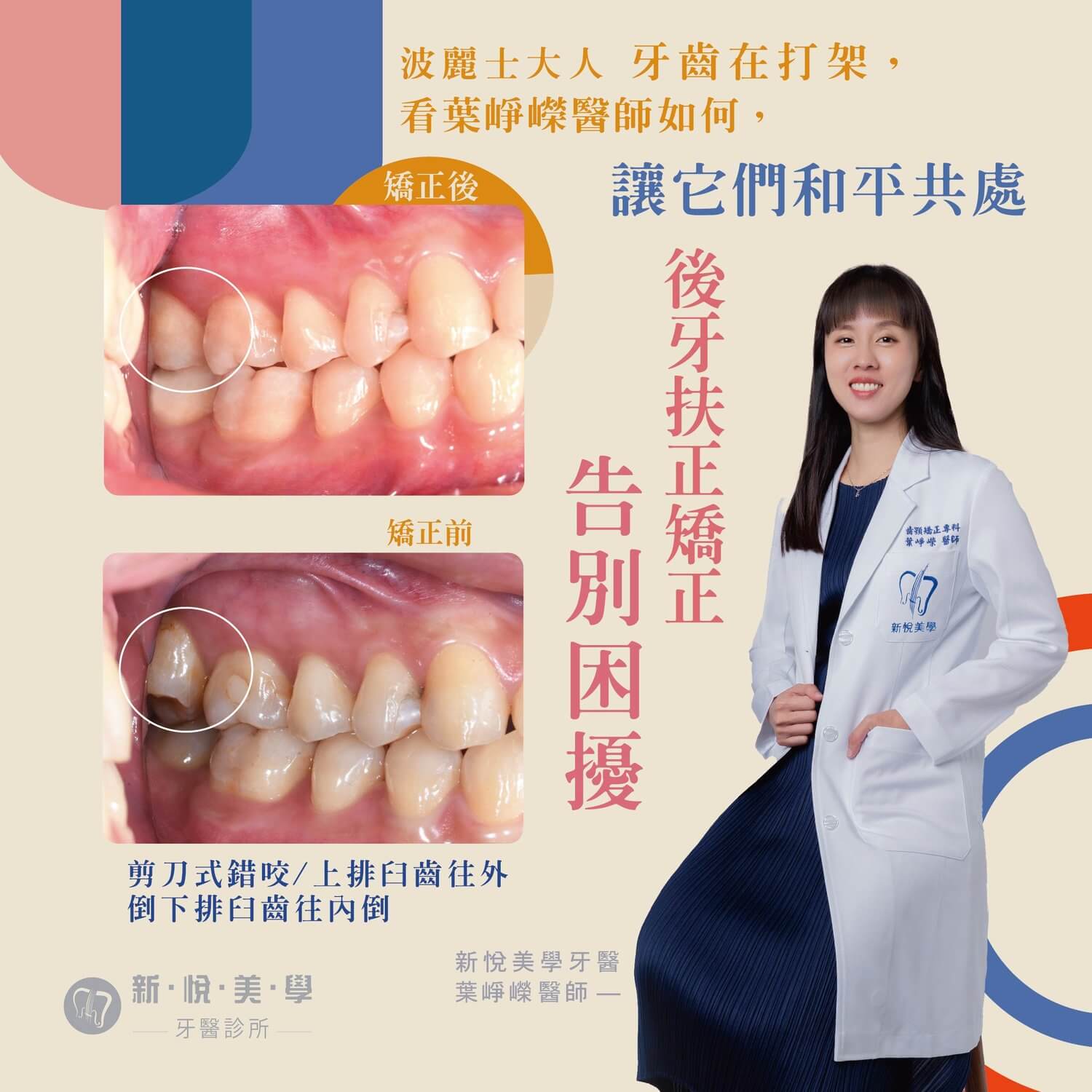 新悅美學牙醫診所的案例分享圖片