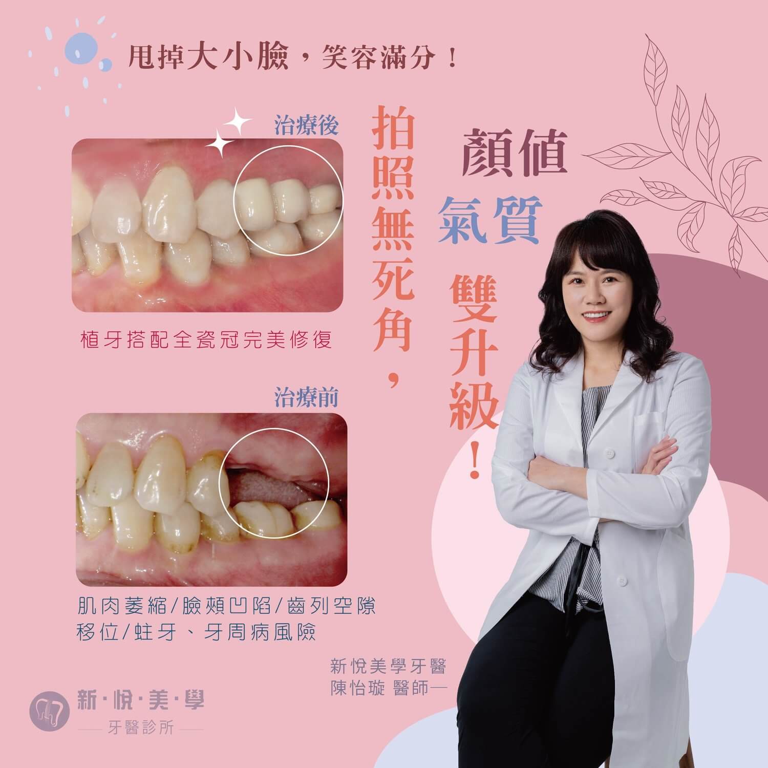 新悅美學牙醫診所的案例分享圖片