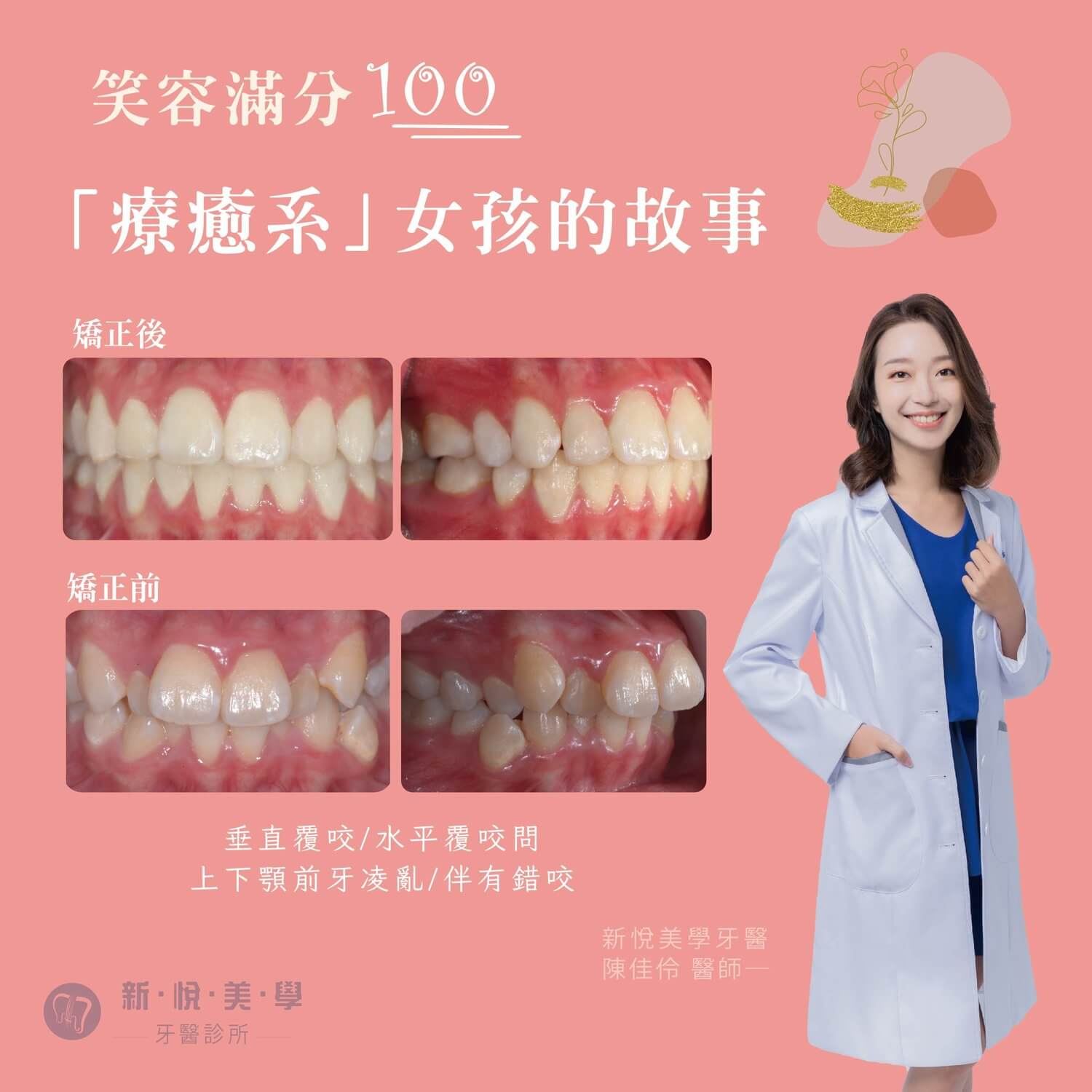 新悅美學牙醫診所的案例分享圖片