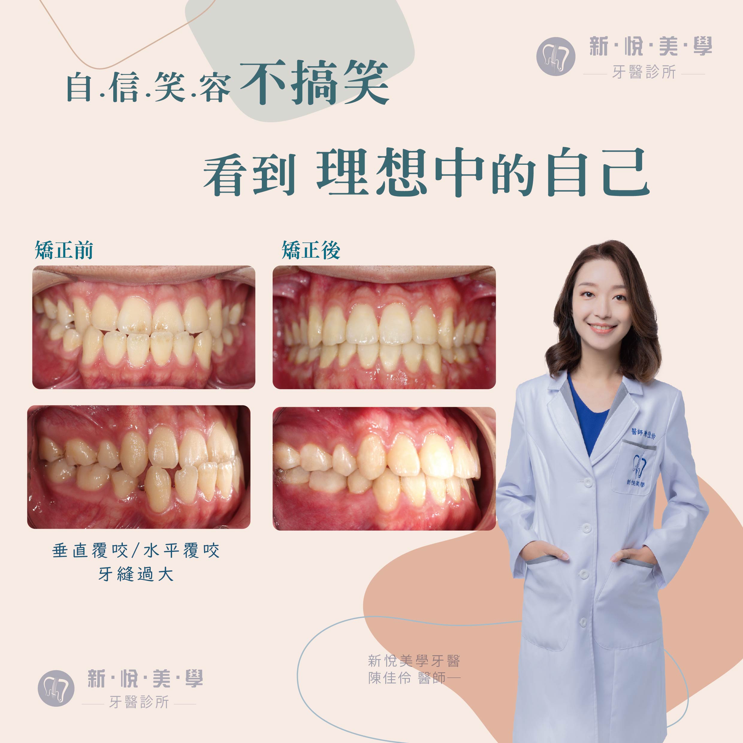 新悅美學牙醫診所的案例分享圖片