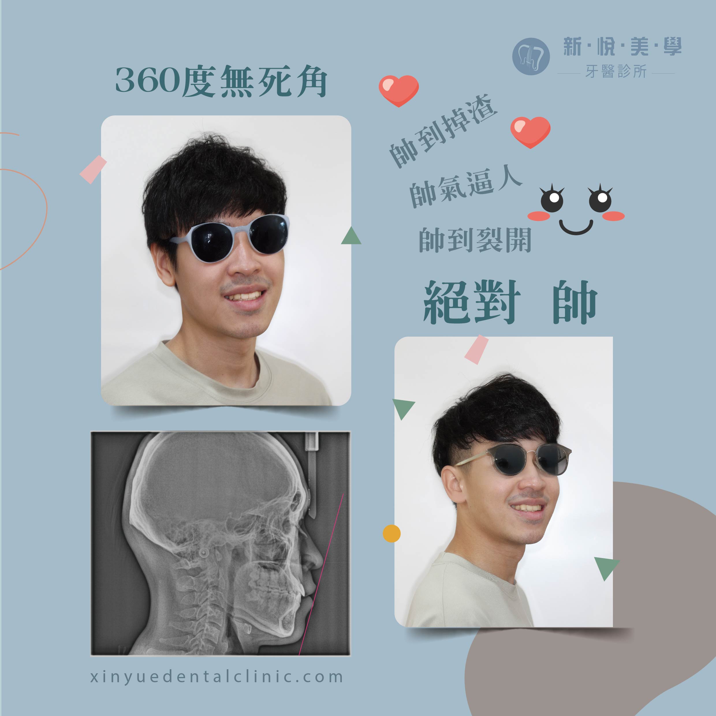 戽斗不再是困擾！非手術矯正的第4張圖片