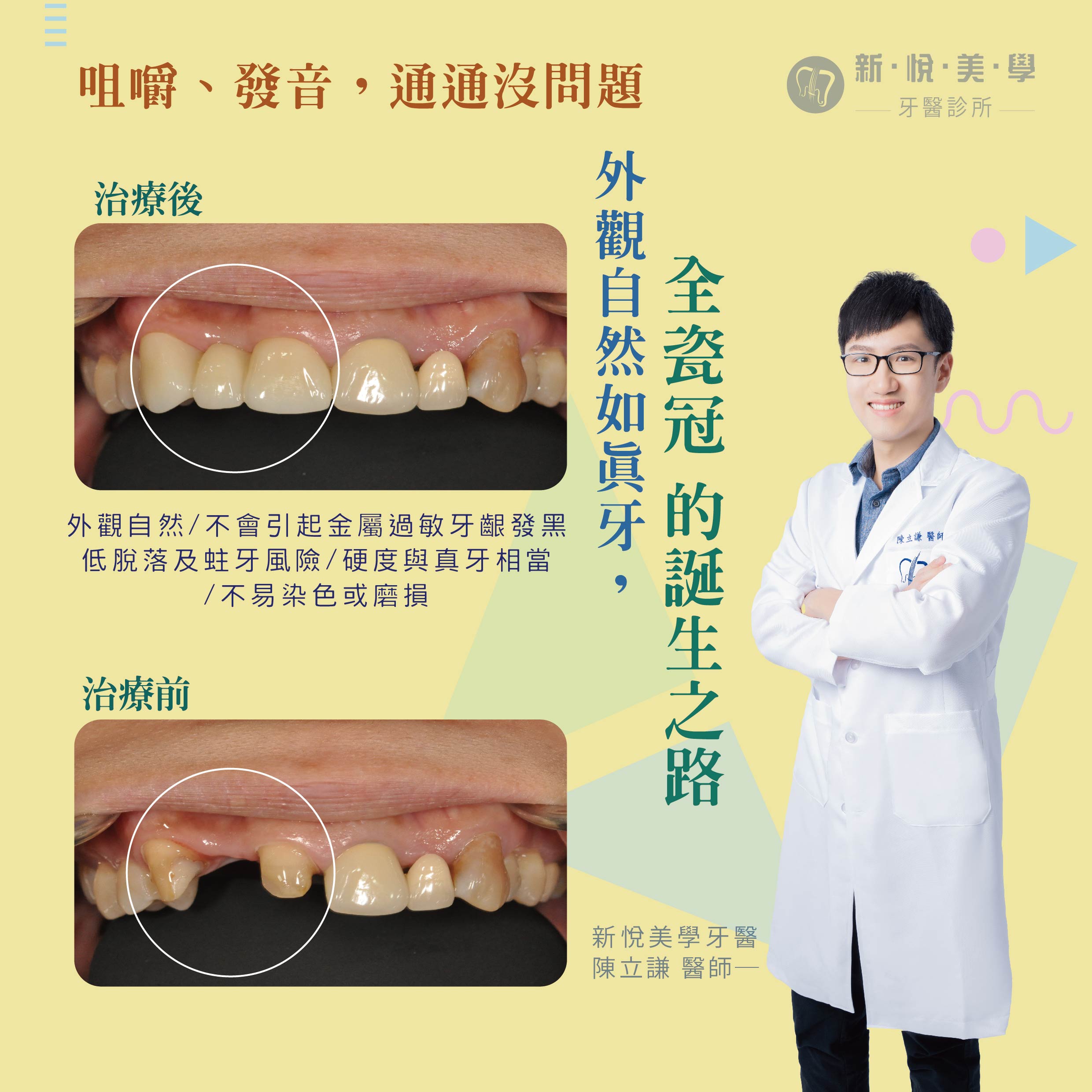新悅美學牙醫診所的案例分享圖片