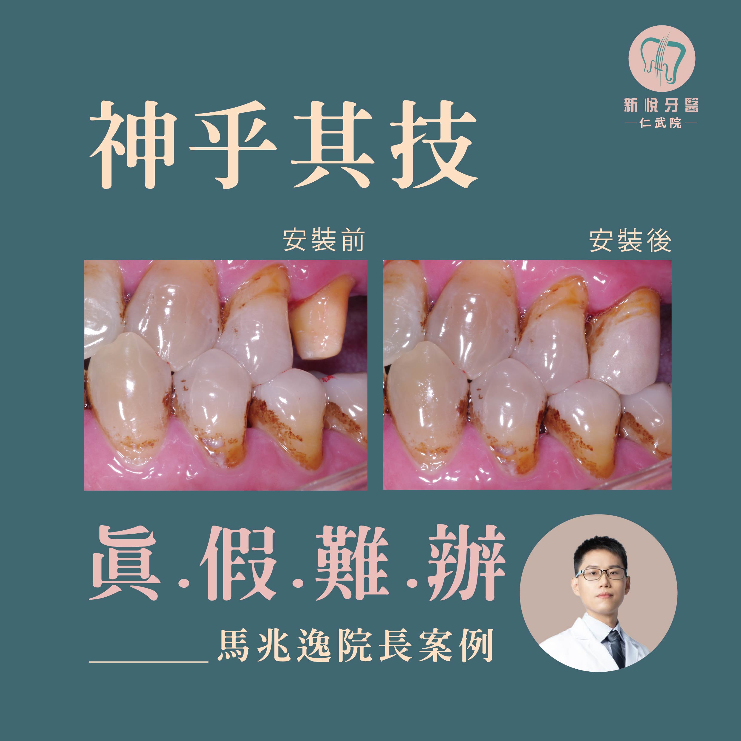 真假難辨，完美神技的第2張圖片