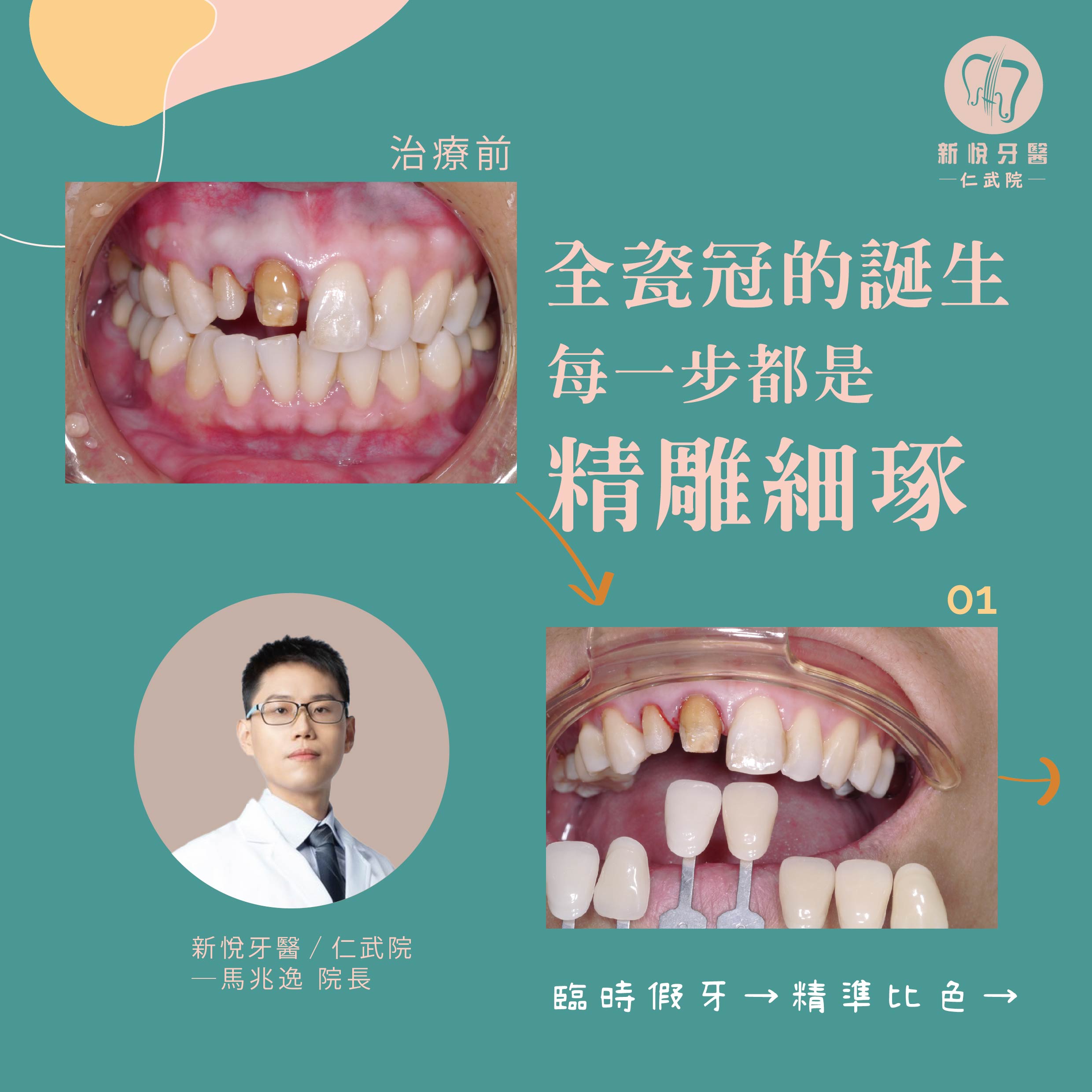 新悅美學牙醫診所的案例分享圖片
