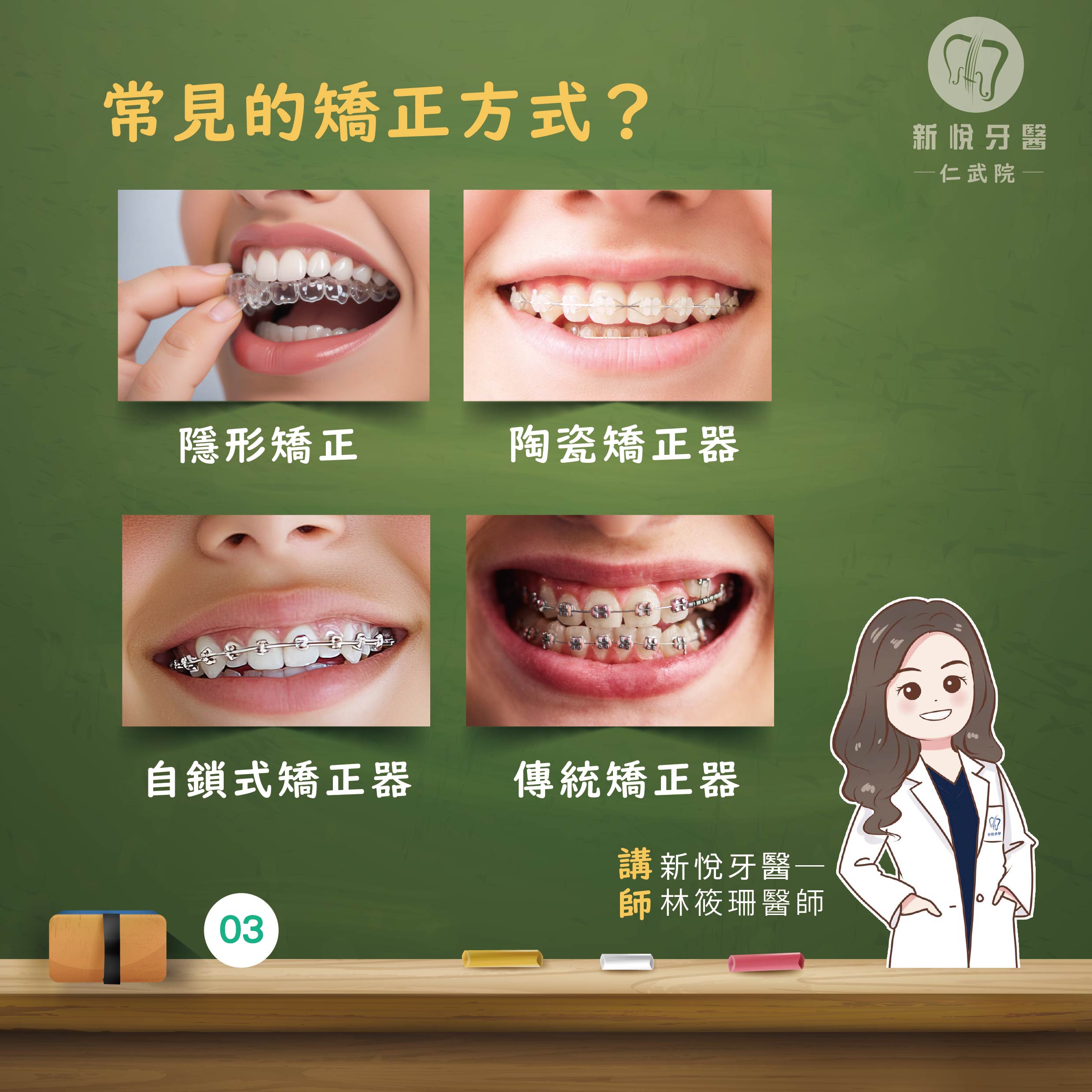 牙齒排列整齊，笑起來更迷人！口腔更健康！的第4張圖片