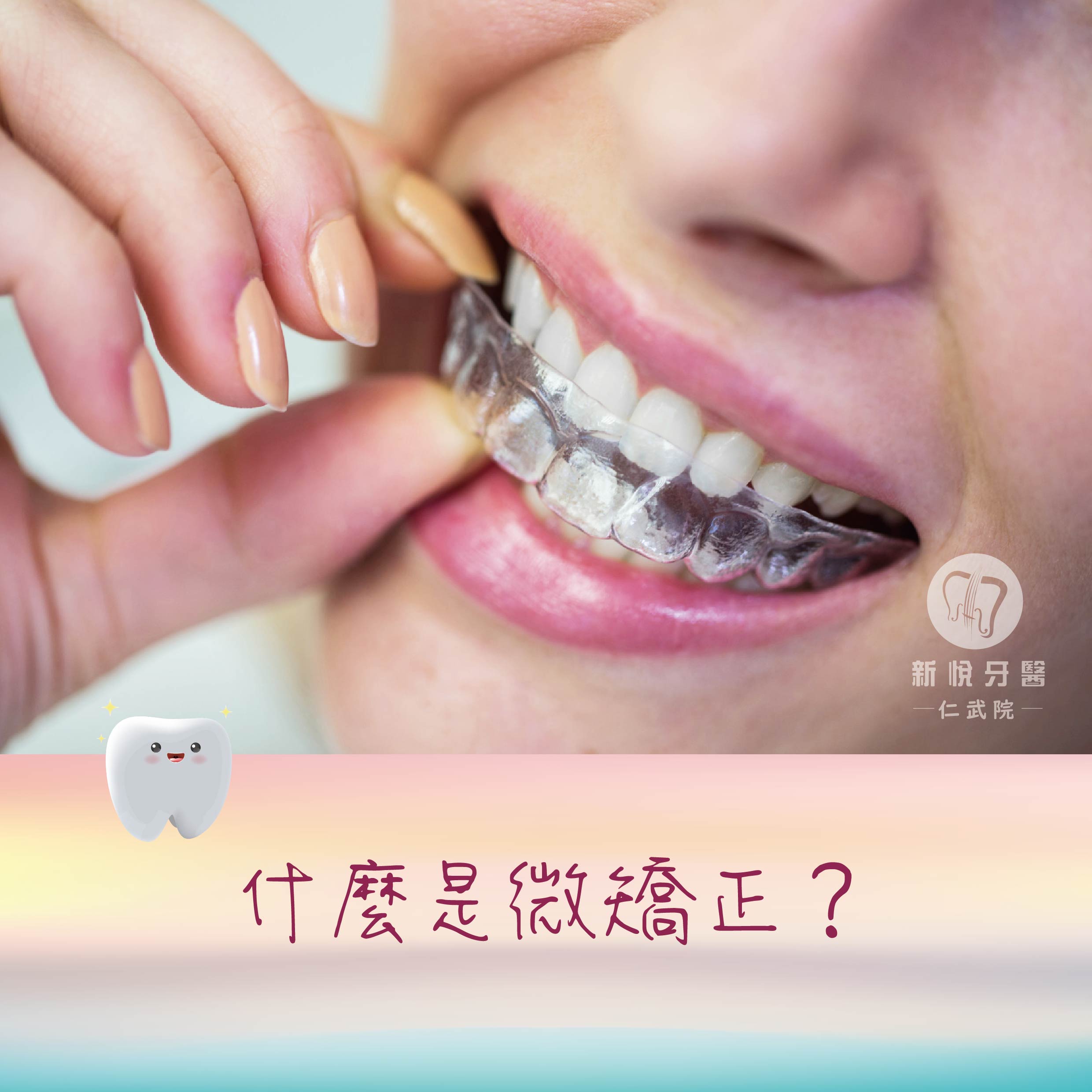 新悅美學牙醫診所的衛教專區圖片