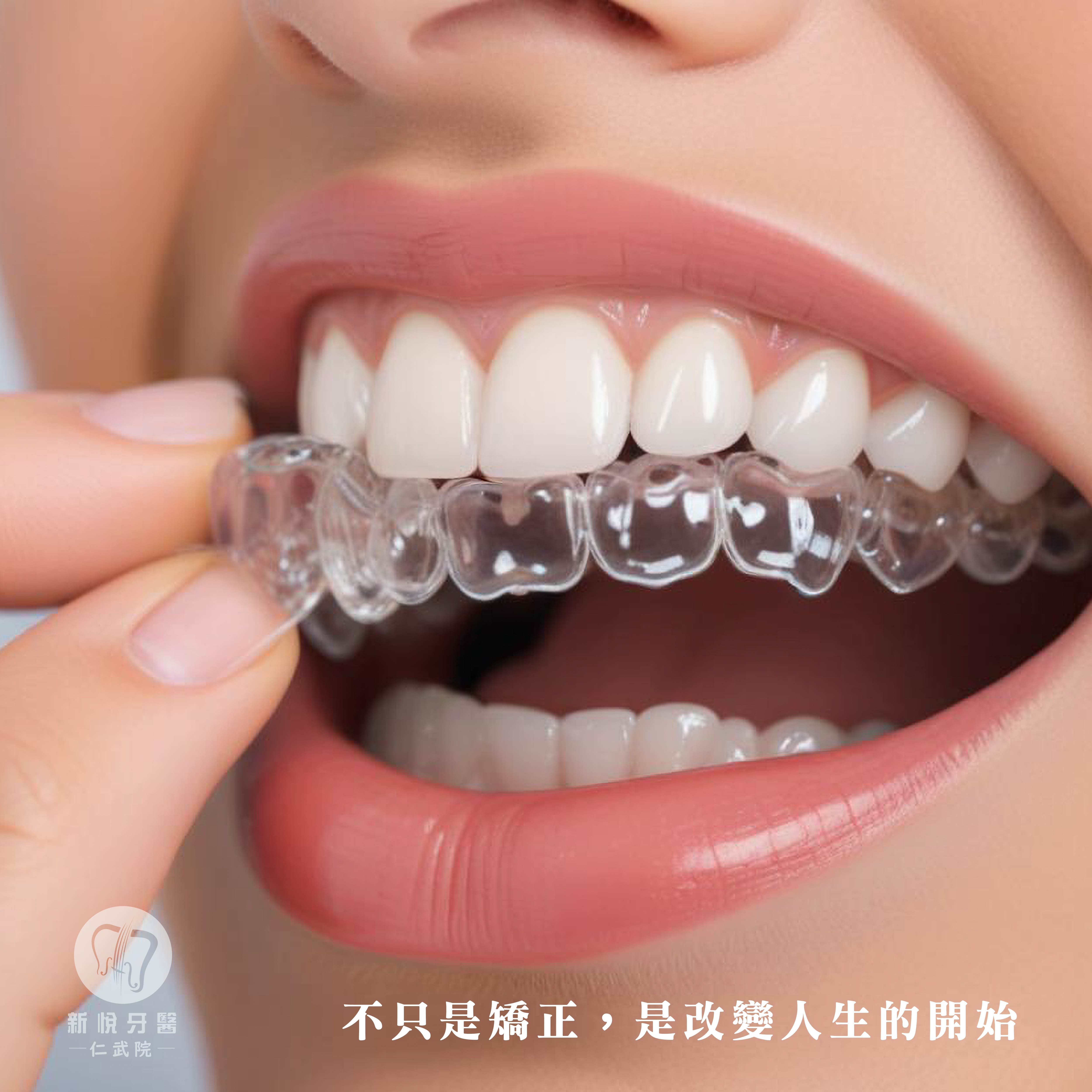 從顏值到健康，矯正專科醫師幫你一次到位！的第2張圖片