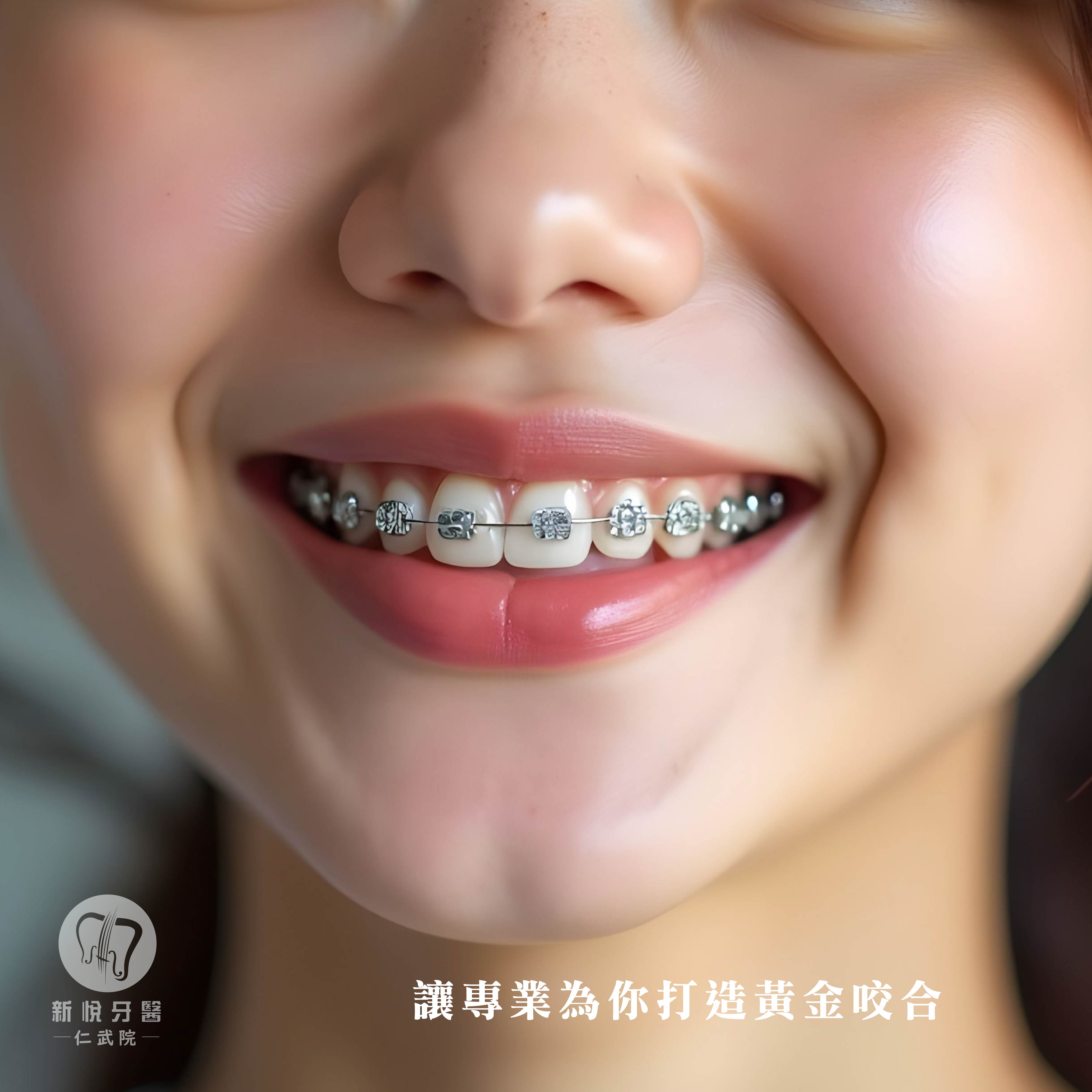 從顏值到健康，矯正專科醫師幫你一次到位！的第3張圖片