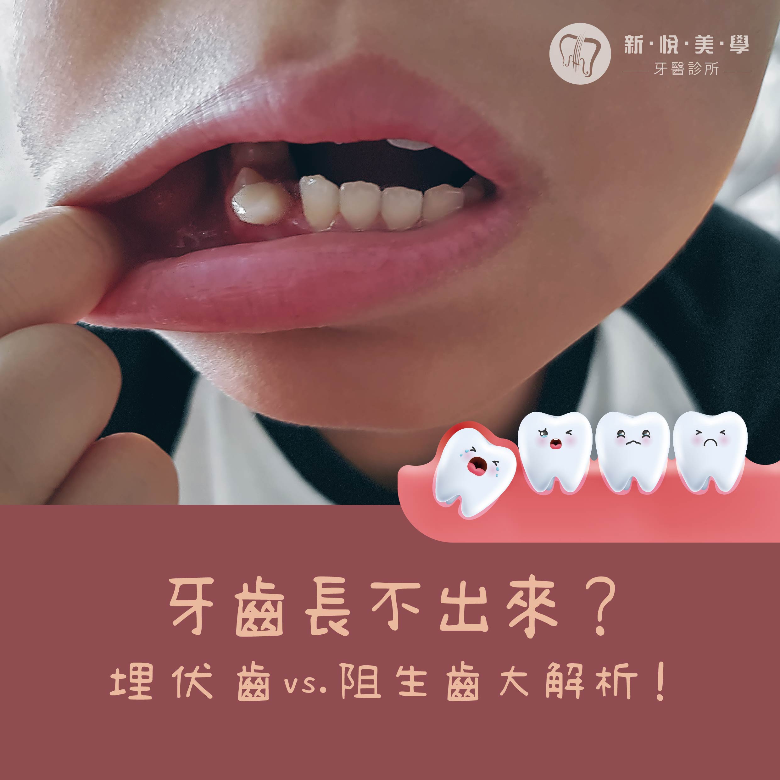 新悅美學牙醫診所的衛教專區圖片