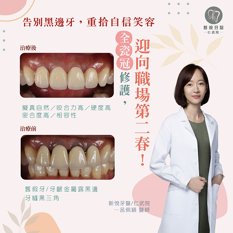 新悅美學牙醫診所的案例分享圖片