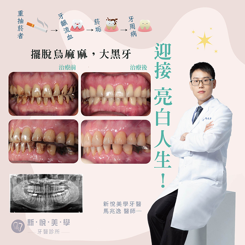 新悅美學牙醫診所的案例分享圖片